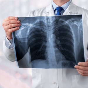 Missouri Court of Appeals Rules Causation Opinion Offered by Treating Physician at Trial Must Be Disclosed in Discovery